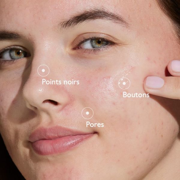 Caudalie Vinopure Ser A-Imperfect 30Ml