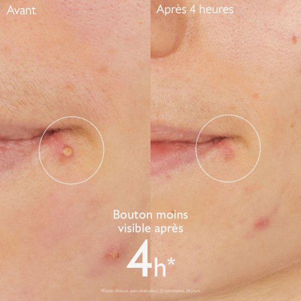 Caudalie Vinopure Stop Boutons Salic 15Ml